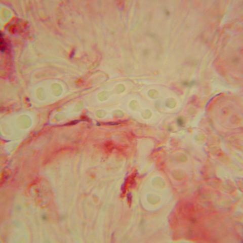 Flavoplaca calcitrapa 1.jpg