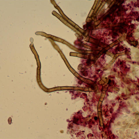 Cladosporium-licheniphilum1.jpg