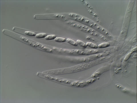 Phomatospora berkeleyi A05419