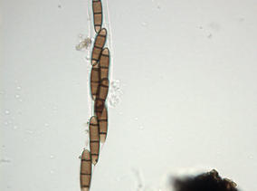 Hysterium pulicare A04499.jpg