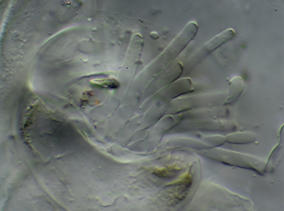 Ramularia pratensis A28910